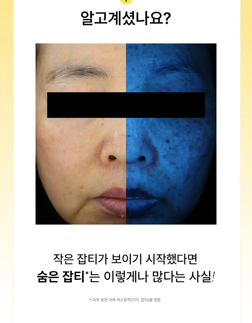 [기미패치] 아크로패스 다크스팟케어 6매입 상세페이지 3